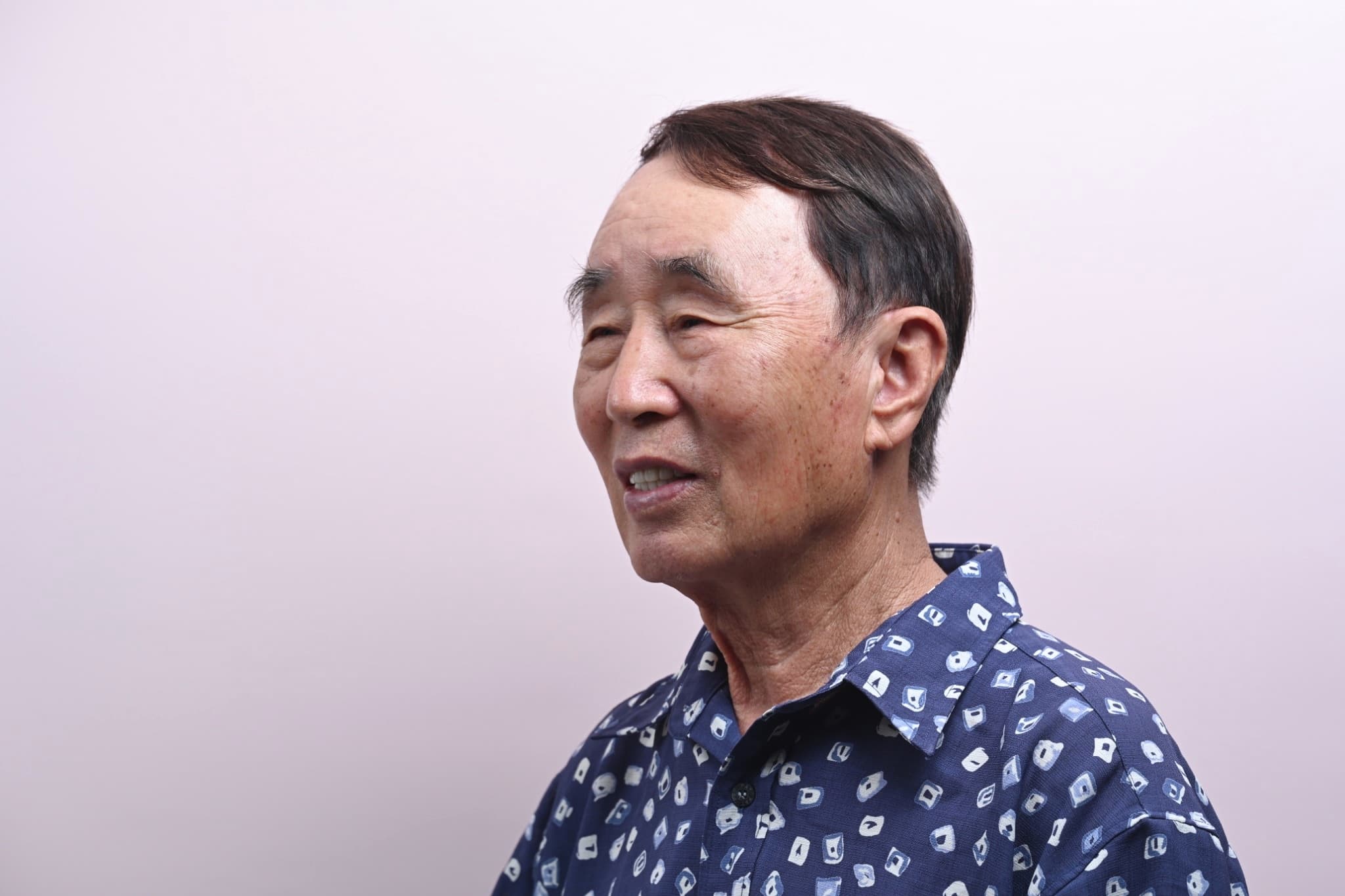 동일 환자의 풀아치 임플란트 치료 후 환자 측모